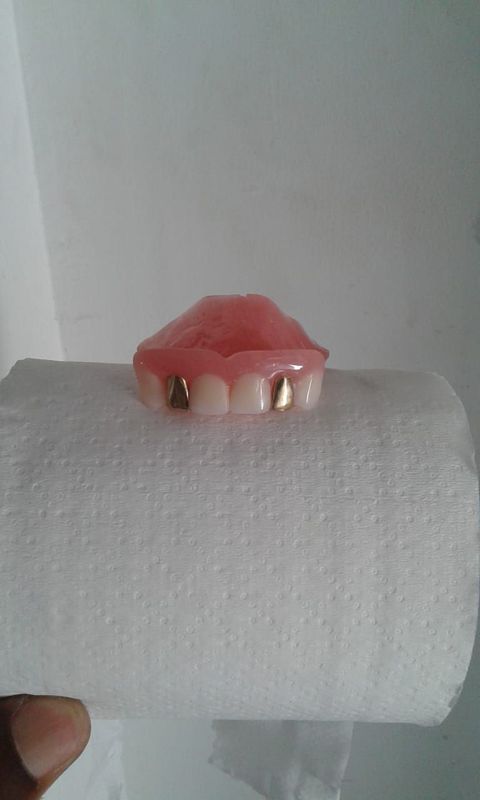 FALSE TEETH ( DENTURE)