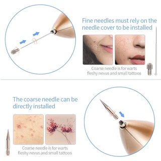 Mole Beauty Spot Remover Pen
