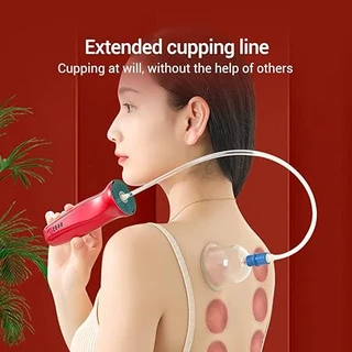 Intelligent Cupping Device