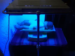 Phototherapy Light for jaundice in new born treatment. For Rent.