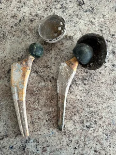 I am looking for a titanium hip replacement