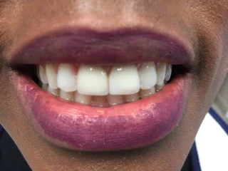 Dental Assistant