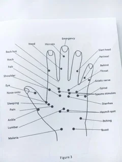 Electronic Acupuncture Pen