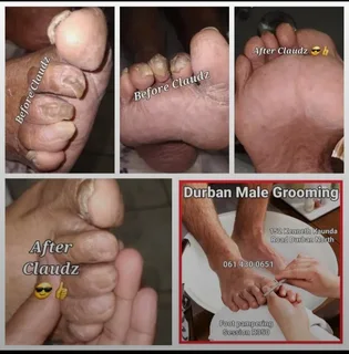 Professional Male Grooming services in Durban North, hair removal treatments, Pelvic hair removal.