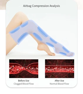 Air Pressure Leg Massager - Promotes Blood Circulation (10005985)