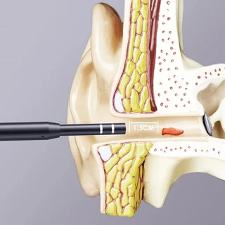 Buy Ear Cleaning Otoscope Camera 5.5MM 3in1 - Examine and Clean Ears Easily