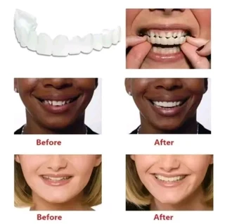 Snap On Silicone Smile veneers Teath Dentures Fake Tooth Cover Sold As A Set