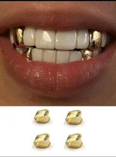 Gold plated grills