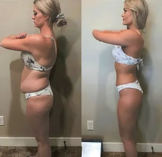 Slimming and Detox Treatments