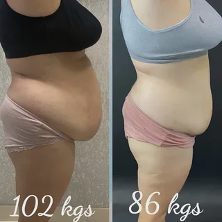 Slimming and Detox Treatments