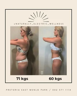 Professional Slimming Machine – Imported from Europe, Built to last