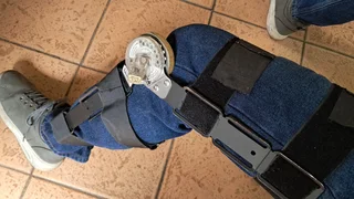 Post OP LEG and KNEE brace