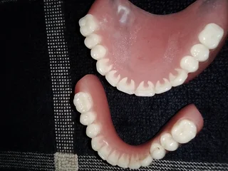 False teeth,Dentures
