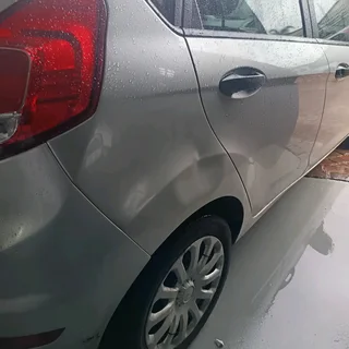 Alu Dent removal