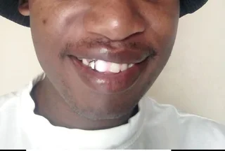 Perfect smile Cut-Able teeth veneers, suitable for top or bottom Cut &amp; Use