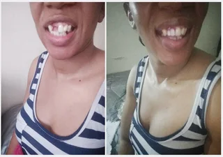 Perfect smile Cut-Able teeth veneers, suitable for top or bottom Cut &amp; Use